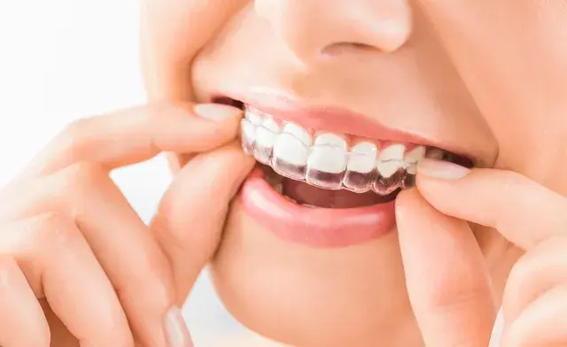 Appareillage orthodontique