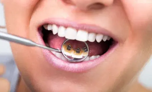 Qu’est-ce que l’orthodontie 