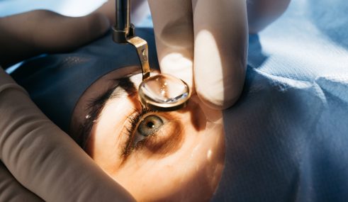 Image illustrant la préparation à une opération de l’œil pour une chirurgie de la cataracte, mettant en avant les étapes avant l’intervention. Image illustrant la préparation à une opération de l'œil pour une chirurgie de la cataracte, mettant en avant les étapes avant l'intervention.