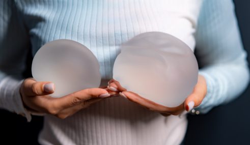 Femme tenant deux prothèses mammaires devant sa poitrine après une mastectomie Femme tenant deux prothèses mammaires devant sa poitrine après une mastectomie